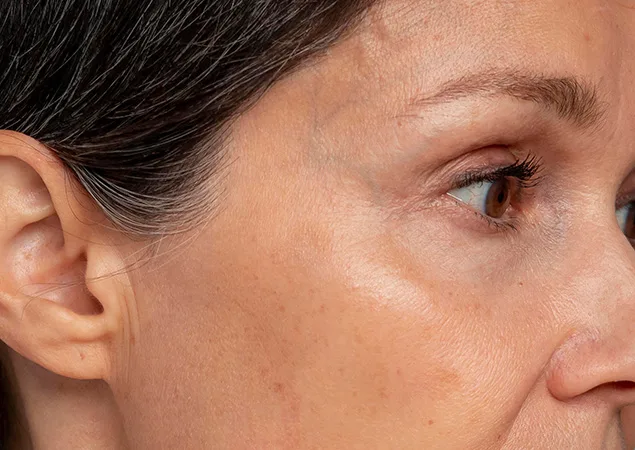 transformation-img-3 transformation-img-3